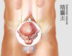 长治泌尿专科医院