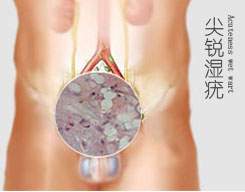 长治泌尿专科医院