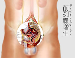 长治泌尿专科医院