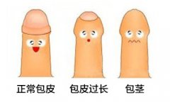长治泌尿专科医院